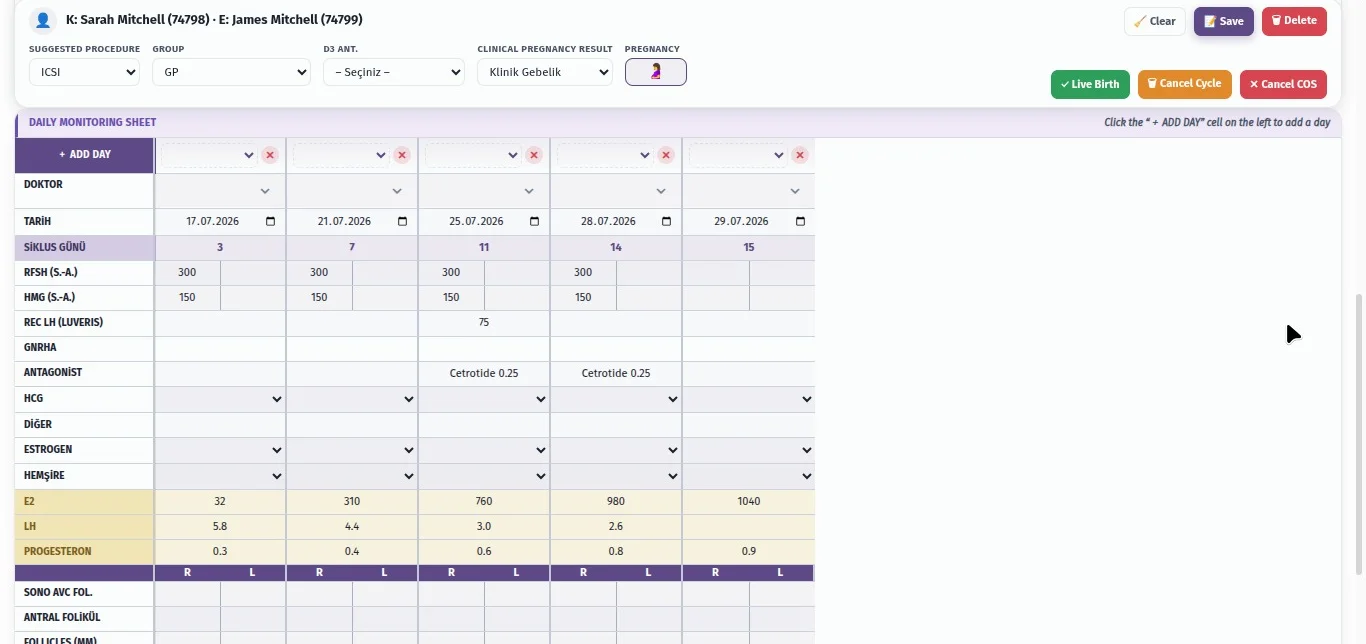Daily ovarian stimulation monitoring sheet with per-day gonadotropin doses, antagonist, E2, LH and progesterone values and per-side follicle counts